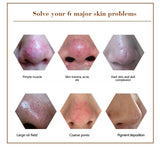Face Care Blackhead Remover
